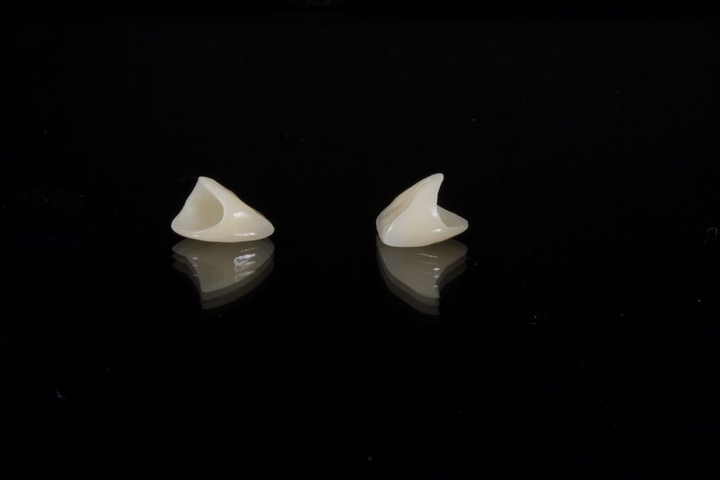 dental, porcelain tooth, wax